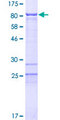 BRD9 Protein - 12.5% SDS-PAGE of human BRD9 stained with Coomassie Blue