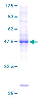 BRF1 Protein - 12.5% SDS-PAGE of human BRF1 stained with Coomassie Blue