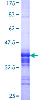 BRF2 Protein - 12.5% SDS-PAGE Stained with Coomassie Blue.