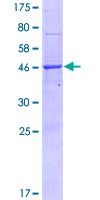 BRI3BP Protein - 12.5% SDS-PAGE of human BRI3BP stained with Coomassie Blue