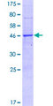 BRI3BP Protein - 12.5% SDS-PAGE of human BRI3BP stained with Coomassie Blue