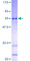 BRINP1 / DBC1 Protein - 12.5% SDS-PAGE of human DBC1 stained with Coomassie Blue