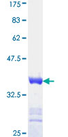 BRINP1 / DBC1 Protein - 12.5% SDS-PAGE Stained with Coomassie Blue.