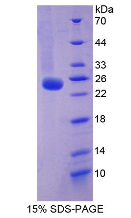 BRINP3 / FAM5C Protein - Recombinant Family With Sequence Similarity 5, Member C By SDS-PAGE