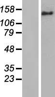 BRIP1 / BACH1 Protein - Western validation with an anti-DDK antibody * L: Control HEK293 lysate R: Over-expression lysate