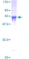 BRMS1 Protein - 12.5% SDS-PAGE of human BRMS1 stained with Coomassie Blue