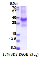 BRMS1 Protein