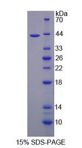 BRP44L Protein - Recombinant Brain Protein 44 Like Protein(BRP44L) By SDS-PAGE