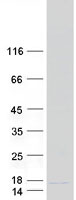 BRP44L Protein - Purified recombinant protein MPC1 was analyzed by SDS-PAGE gel and Coomassie Blue Staining