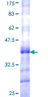 BRPF1 Protein - 12.5% SDS-PAGE Stained with Coomassie Blue.