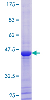 BRSK2 Protein - 12.5% SDS-PAGE of human BRSK2 stained with Coomassie Blue