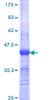 BRUCE / BIRC6 Protein - 12.5% SDS-PAGE Stained with Coomassie Blue.