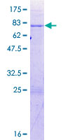 BRUNOL6 / CELF6 Protein - 12.5% SDS-PAGE of human BRUNOL6 stained with Coomassie Blue