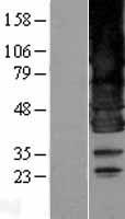 BSCL2 Protein - Western validation with an anti-DDK antibody * L: Control HEK293 lysate R: Over-expression lysate