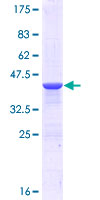 BSCL2 Protein - 12.5% SDS-PAGE Stained with Coomassie Blue.