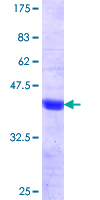 BSND / Barttin Protein - 12.5% SDS-PAGE Stained with Coomassie Blue