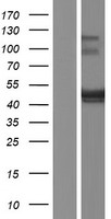 BSPRY Protein - Western validation with an anti-DDK antibody * L: Control HEK293 lysate R: Over-expression lysate
