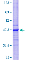 BST2 Protein - 12.5% SDS-PAGE of human BST2 stained with Coomassie Blue