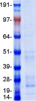 BST2 Protein - Purified recombinant protein BST2 was analyzed by SDS-PAGE gel and Coomassie Blue Staining