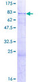 BTBD1 Protein - 12.5% SDS-PAGE of human BTBD1 stained with Coomassie Blue