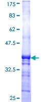 BTBD1 Protein - 12.5% SDS-PAGE Stained with Coomassie Blue.