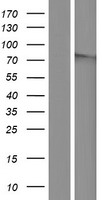 BTBD11 Protein - Western validation with an anti-DDK antibody * L: Control HEK293 lysate R: Over-expression lysate