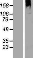 BTBD16 Protein - Western validation with an anti-DDK antibody * L: Control HEK293 lysate R: Over-expression lysate