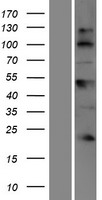 BTBD17 Protein - Western validation with an anti-DDK antibody * L: Control HEK293 lysate R: Over-expression lysate