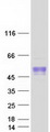 BTBD17 Protein - Purified recombinant protein BTBD17 was analyzed by SDS-PAGE gel and Coomassie Blue Staining