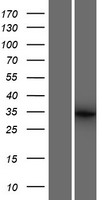 BTBD19 Protein - Western validation with an anti-DDK antibody * L: Control HEK293 lysate R: Over-expression lysate