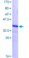 BTBD2 Protein - 12.5% SDS-PAGE Stained with Coomassie Blue.