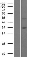BTBD7 Protein - Western validation with an anti-DDK antibody * L: Control HEK293 lysate R: Over-expression lysate
