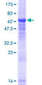 BTBD8 Protein - 12.5% SDS-PAGE of human BTBD8 stained with Coomassie Blue
