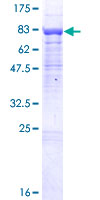 BTBD9 Protein - 12.5% SDS-PAGE of human BTBD9 stained with Coomassie Blue