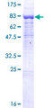 BTBD9 Protein - 12.5% SDS-PAGE of human BTBD9 stained with Coomassie Blue
