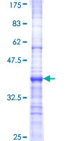 BTBD9 Protein - 12.5% SDS-PAGE Stained with Coomassie Blue.