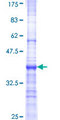 BTBD9 Protein - 12.5% SDS-PAGE Stained with Coomassie Blue.