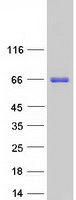 BTBD9 Protein - Purified recombinant protein BTBD9 was analyzed by SDS-PAGE gel and Coomassie Blue Staining