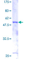 BTC / Betacellulin Protein - 12.5% SDS-PAGE of human BTC stained with Coomassie Blue
