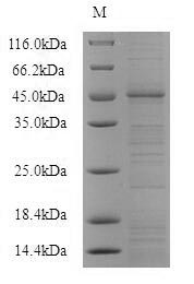 BTC / Betacellulin Protein - (Tris-Glycine gel) Discontinuous SDS-PAGE (reduced) with 5% enrichment gel and 15% separation gel.