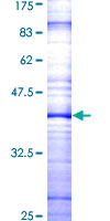 BTC / Betacellulin Protein - 12.5% SDS-PAGE Stained with Coomassie Blue.