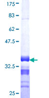 BTEB / KLF9 Protein - 12.5% SDS-PAGE Stained with Coomassie Blue.