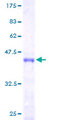 BTF3 Protein - 12.5% SDS-PAGE of human BTF3 stained with Coomassie Blue