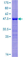 BTF3L4 Protein - 12.5% SDS-PAGE of human BTF3L4 stained with Coomassie Blue