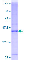 BTG1 Protein - 12.5% SDS-PAGE of human BTG1 stained with Coomassie Blue