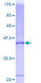 BTG1 Protein - 12.5% SDS-PAGE of human BTG1 stained with Coomassie Blue