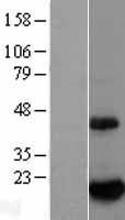 BTG2 Protein - Western validation with an anti-DDK antibody * L: Control HEK293 lysate R: Over-expression lysate