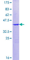 BTG2 Protein - 12.5% SDS-PAGE of human BTG2 stained with Coomassie Blue