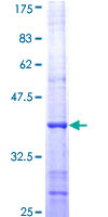 BTG2 Protein - 12.5% SDS-PAGE Stained with Coomassie Blue.