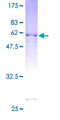 BTG3 Protein - 12.5% SDS-PAGE of human BTG3 stained with Coomassie Blue